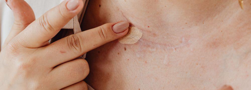 woman touching scar on neck with finger